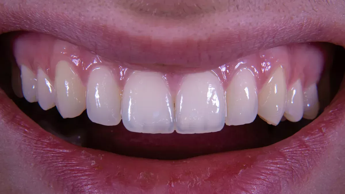 Is Teeth Polishing the Same as Teeth Whitening?